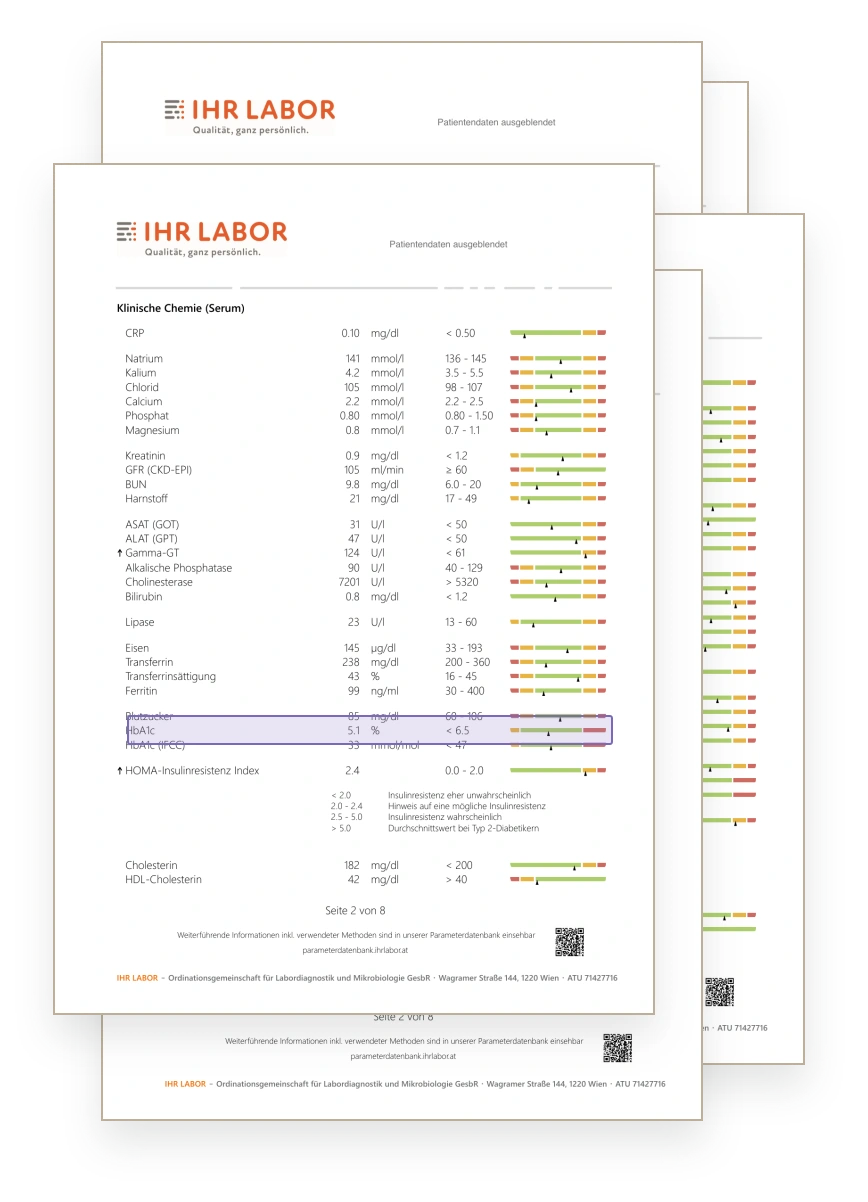 A pack of lab reports from the deck, with patient details hidden and the HbA1c value highlighted.